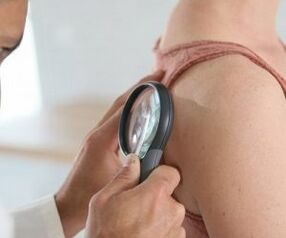 Wie man den menschlichen Papillomavirus bestimmt