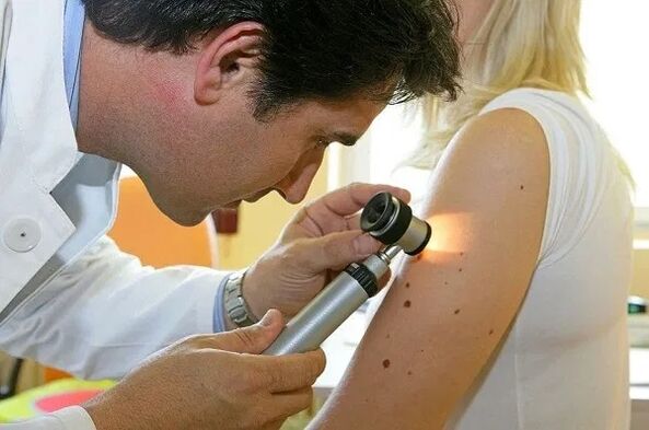 Diagnose von Papillomen
